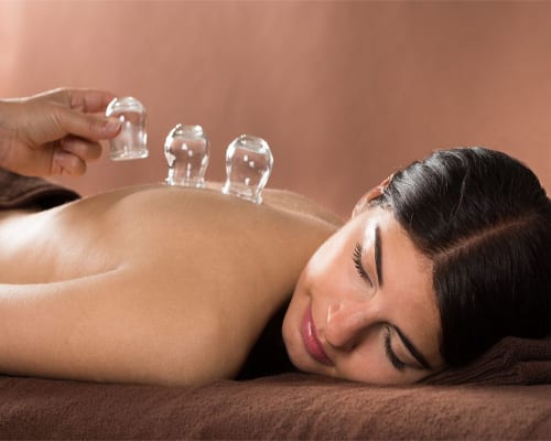 cupping